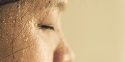 Aşırı terlemenin 7 önemli nedeni!