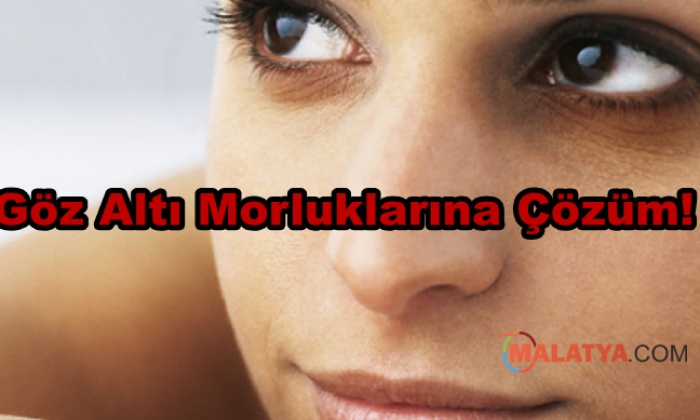 Göz Altı Morluklarına Çözüm!