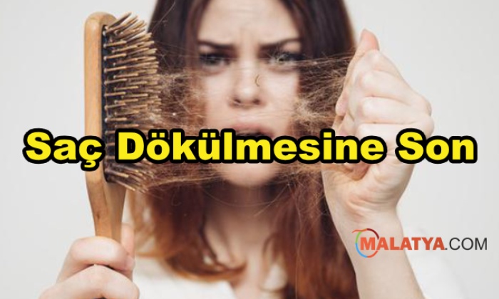 Saç Dökülmesine Son