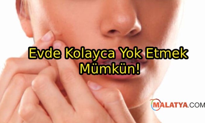 Siyah Noktalardan Kurtulmanın Yolları