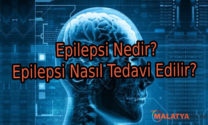 Epilepsi Nedir? Epilepsi Nasıl Tedavi Edilir?