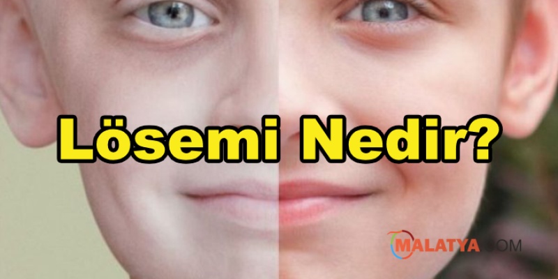 Lösemi Nedir?