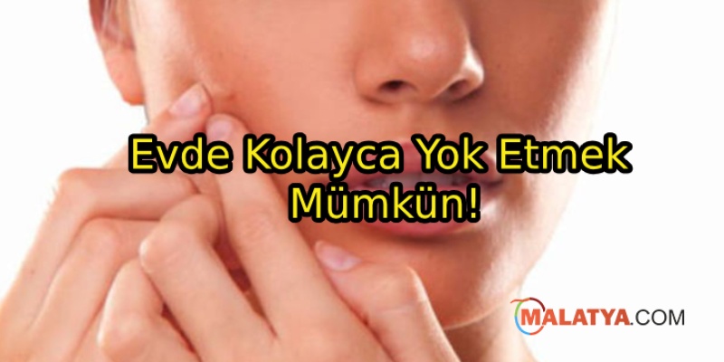 Siyah Noktalardan Kurtulmanın Yolları