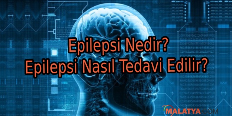 Epilepsi Nedir? Epilepsi Nasıl Tedavi Edilir? 